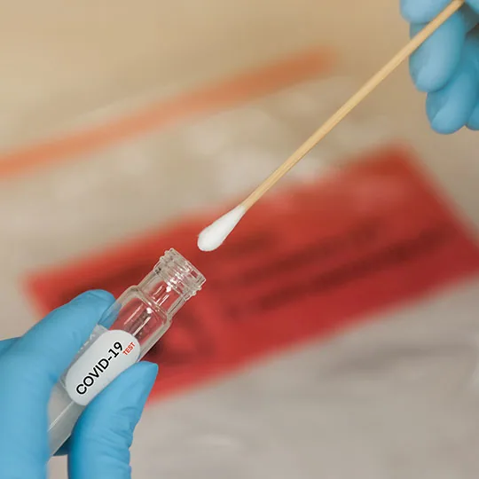 COVID-19 test